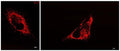 Staining of mitochondria in HeLa cells.