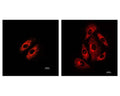 Staining in cultured cells with TR-603-P2 tracing reagent (Left: cardiomyocytes; Right: H9c2 cells).