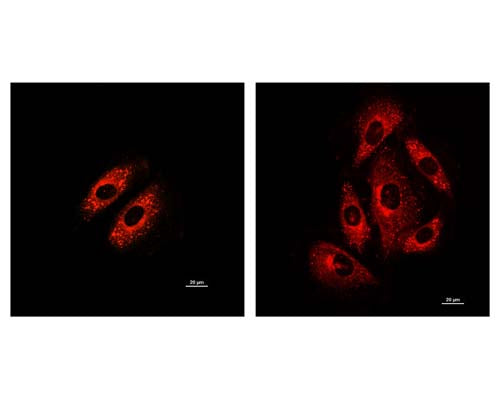 Staining in cultured cells with TR-603-P2 tracing reagent (Left: cardiomyocytes; Right: H9c2 cells).