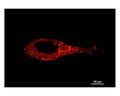 Staining of cultured cells (LNCaP prostate cancer cells)
