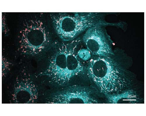 Staining in cells with TR-605-ER2 tracing reagent.