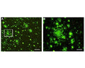 Labelling of amyloid plaques (green) in paraffin-processed cortex from a 1 year old APP/PSI mouse model of AD (A). B: High-magnification view of the cortical region outlined in white in A.