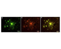 HQ-O stained plaques can be seen within the CA-1 region of the hippocampus (D). This same field of view stained with immunofluorescent methods using the Aβx-40/42 MOAB-2 antibody, M-1586-100. Biosensis antibody reveals a similar but somewhat more restricted labeling of the same amyloid plaques (E), which is apparent when the images are merged (F).  Photo taken with permission from Current Alzheimer Research, 2019, Vol. 16, No. 7 583, Figure 4.