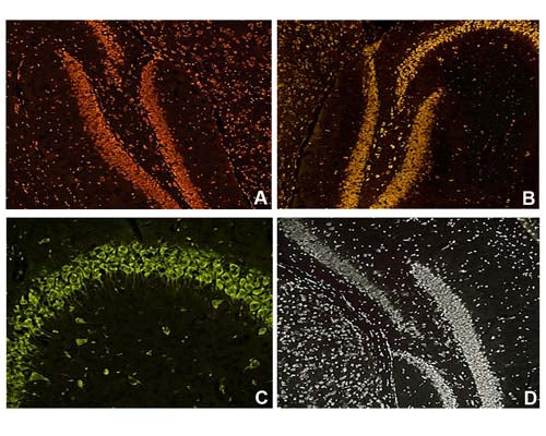 Image of mouse brain tissue by Immunofluorescence). Image A stained with NisslFluor™ Red (TR-200-NRD); Image B stained with NisslFluor™ Orange (TR-210-NOR); Image C stained with NisslFluor™ Green (TR-220-NGN); Image D stained with NisslFluor™Silver (TR-230-NSL); Prominent staining of neuronal soma and dendrites is observed, characteristic of healthy neurons.