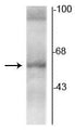 Western blot of rat hippocampal lysate showing specific immunolabeling of the ~58 kDa TR-α2 protein. 