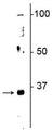 Western blot of neonatal rat brain lysate showing specific immunolabeling of the ~32 kDa Olig2 protein.