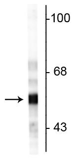 Western blot of rat cerebellar lysate showing specific immunolabeling of the ~57 kDa peripherin protein.