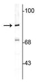 Western blot of rat cortical lysate showing specific immunolabeling of the ~82 kDa rabphilin 3A. 