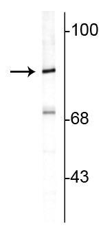 Western blot of rat cortical lysate showing specific immunolabeling of the ~82 kDa rabphilin 3A. 