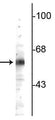 Western blot of rat cerebellum lysate showing specific immunolabeling of the ~64 kDa TR4 protein. 