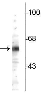 Western blot of rat cerebellum lysate showing specific immunolabeling of the ~64 kDa TR4 protein. 