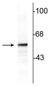 Western blot of 10ug of rat striatal lysate showing specific immunolabeling of the ~60 kDa tyrosine hydroxylase protein.