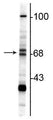 Western blot of rat hippocampal lysate showing specific immunolabeling of the ~68/70 kDa ChAT. 