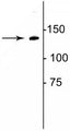 Western blot of rat lung lysate showing specific immunolabeling of the ~140 kDa collagen protein.