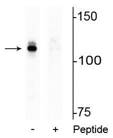 Western blot of HeLa lysate showing specific immunolabeling of the ~110 kDa AR protein phosphorylated at Ser94 in the first lane (-). Phosphospecificity is shown in the second lane (+) where the immunolabeling is blocked by the phosphopeptide used as antigen but not by the corresponding non-phosphopeptide (not shown).