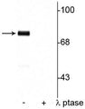 Western blot of rat cortical lysate showing specific immunolabeling of the ~78 kDa synapsin I phosphorylated at Ser9 in the first lane (-). Phosphospecificity is shown in the second lane (+) where the immunolabeling is completely eliminated by blot treatment with lambda phosphatase (λ-Ptase, 1200 units for 30 minutes).