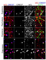 Immunofluorescence showing SCP3 (green) and the co-localization of VCL (red) and CREST-labeling centromeres (blue) on squashed mouse spermatocytes. Image from publication CC-BY-4.0. PMID: 35805097