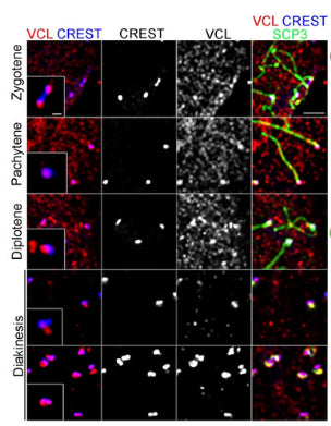 Immunofluorescence showing SCP3 (green) and the co-localization of VCL (red) and CREST-labeling centromeres (blue) on squashed mouse spermatocytes. Image from publication CC-BY-4.0. PMID: 35805097