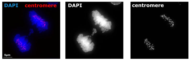 A microscopy image of a cell from BJ hTERT cell line treated with aphidicolin to induce genomic instability. Immunolabeling of the cell positively labelling CREST/Centromere Protein (red, 1:500, Cat No. 15-234) and labelling DNA with DAPI. The anaphase cell has a segregation error which lacks centromeric staining unlike the mass of properly segregating chromosomes. Image kindly provided by Nadeem Shaikh and Sarah McClelland from Barts Cancer Institute, Queen Mary University of London.  