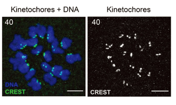 Representative maximum z-projections of in situ chromosome spreads from a mouse euploid egg (kinetochores (CREST), green or gray scale) (DNA, blue). Image from publication CC-BY-4.0. PMID: 35810327