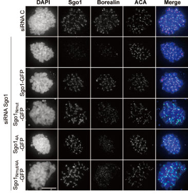 Immunofluorescence of HeLa Kyoto cells transiently expressing different Sgo1-GFP constructs (Sgo1-GFP, Sgo1Nmut-GFP, Sgo14A-GFP, or Sgo1Nmut/4A-GFP) and depleted of endogenous Sgo1 using siRNA oligonucleotides showing endogenous Borealin and ACA. DAPI was used for DNA staining. Image from publication CC-BY-4.0. PMID: 35776132