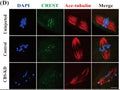 Uninjected, Control, CBS-KD human oocytes cultured in M16 medium for 8 h to MI for immunofluorescence with Mitotic arrest deficiency 1 (MAD1) (red) and human anti-centromere antibody (CREST) (green). Image from publication CC-BY-4.0. PMID: 36053797