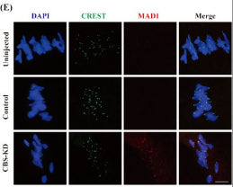 Human oocytes in Uninjected, Control, CBS-KD groups were cultured in M16 medium for 8 h to MI and then incubated on ice for 5 min and processed for immunofluorescence with acetylated α-tubulin (red) and CREST antibody (green). Image from publication CC-BY-4.0. PMID: 36053797