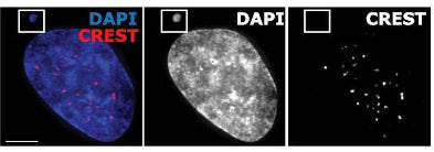 Representative image of RPE1 cell with an acentric micronucleus. CREST antibody was used to stain for presence of centromeric proteins. Image from publication CC-BY-4.0. PMID:36266663