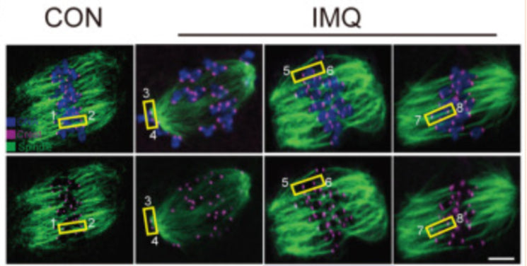 Confocal image of kinetochore-microtubule attachments in mouse control (CON) and IMQ treated oocytes where kinetochores are dyed purple by CREST antibody, microtubules are stained green by the anti-tubulin antibody. Chromosomes are dyed blue by Hoechst 33342.Image from publication CC-BY-4.0. PMID: 35589679