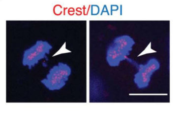 Immunofluorescence images of two siTTLL11 anaphase cells showing chromosome segregation defects including a lagging chromosome (white arrows). Kinetochores were labeled with CREST (red) and DNA with DAPI (blue). Image from publication CC-BY-4.0. PMID:36414642