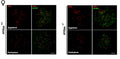 Double immunofluorescence of ACA and SYCP3 in 16.5 dpc mouse oocytes. Image from publication CC-BY-4.0. PMID:36429134