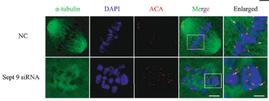 Confocal microscopy showing the spindle structures and distribution of  chromosomes in Sept 9 siRNA at 8 h after cold treatment. Spindle and DNA were stained with α‐tubulin‐FITC (green) antibody and DAPI (blue), respectively. ACA stained red. Image from publication CC-BY-4.0. PMID:36354207