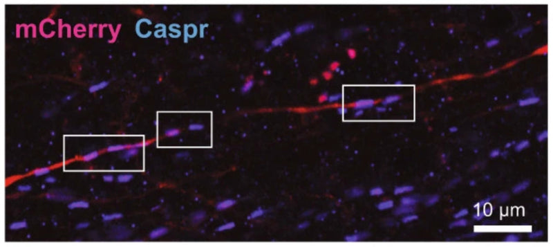 Sagittal section containing the vHPC immunolabeled with CASPR antibody (cat. 75-001, 1:500; cyan) in mice expressing an mCherry-labeled hM3Dq or a control virus in vHPC-to-mPFC projection neurons. Outlines demonstrating paranodes along an mCherry-labeled axon. Image from publication CC-BY-4.0. PMID:36949148