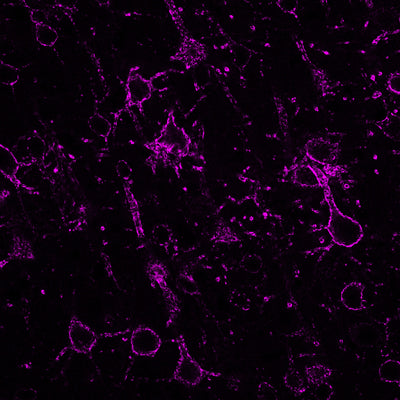 Immunolabeling of principal neurons in the mouse neocortex specifically labeling Kv2.1 channels (1:500). The image is from a CLSM stack, pixel size is 100 nm. The image is kindly provided by Csaba Cserep,  Institute of Experimental Medicine, Budapest, Hungary.