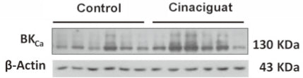 Western blot showing specific labeleing of BKCa/β-Actin in control and and Cinaciguat-treated lambs. Image from publication CC-BY-4.0. PMID: 35733986