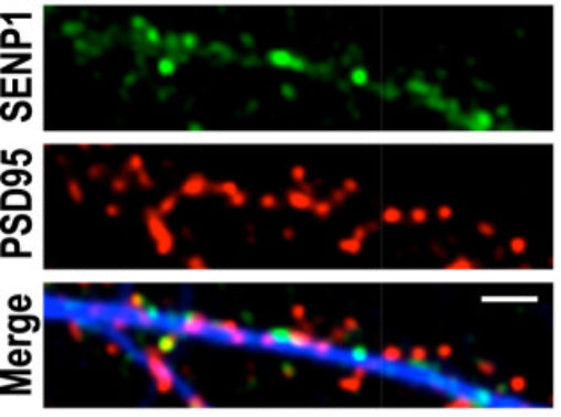 Immunolabelling of fixed primary rat hippocampal neurons for SENP1 and PSD95. Image from publication CC-BY-4.0. PMID: 35739402