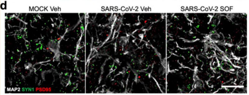 Immunolabeling of Synapsin 1 (SYN1) and PSD95-positive cells (green and red respectively) within MAP2+ neurons (white) in ight-week-old human brain cortical organoids (BCO) infected at MOI 2.5 and treated with vehicle (Veh) or 20μM Sofosbuvir (SOF). Image from publication CC-BY-4.0. PMID:36327326