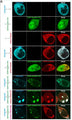Representative images of HEK293 cells transfected with different combinations of PSD95 (Cat. 75-028, 1:2000), GluN2A-CTD, WT, and R9A Rph3A. Image from publication CC-BY-4.0. PMID:36693856