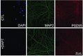 Representative confocal images of mouse cortical neurons using DAPI, MAP2, and PSD95 (Cat. 75-028, 1:1000) in control conditions (upper images) and treated with DAPT inhibitor (lower images). Image from publication CC-BY-4.0. PMID:37059474