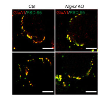 Double staining of GluA1 (red) and PSD-95 (green) in P12 MNTB neurons of control (left) and Nlgn3 KO (right) mice. Image from publication CC-BY-4.0. PMID: 35704570