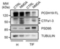 Western blot of total homogenate (H) and TIF fraction from rat hippocampal neurons treated with vehicle (CTRL) or NMDA. Image from publication CC-BY-4.0. PMID: 35613587