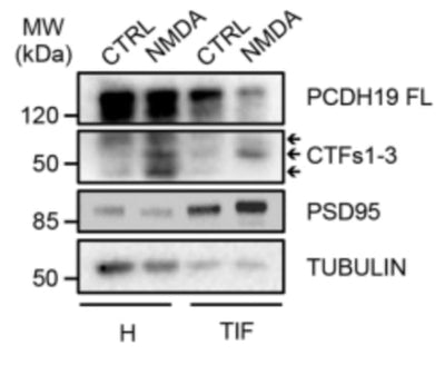 Anti-PSD-95 Antibody (K28/43) | 75-028 Anti-PSD-95 Antibody (K28/43) | 75-028
