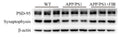 Western blot analysis of PSD-95 and synaptophysin protein in the hippocampus region of AD mice. Image from publication CC-BY-4.0. PMID: 35701825