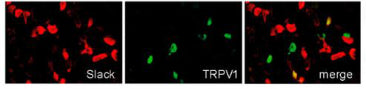 Double-labeling immunostaining of Slack (red) and TRPV1 (green) in DRGs. Image from publication CC-BY-4.0. PMID: 35626730