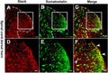 Double immunofluorescence staining revealed the expression of the Slack channel (A,D, in red) in somatostatin positive neurons (B,E, in green). Image from publication CC-BY-4.0. PMID:35359569