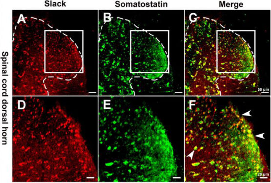 Double immunofluorescence staining revealed the expression of the Slack channel (A,D, in red) in somatostatin positive neurons (B,E, in green). Image from publication CC-BY-4.0. PMID:35359569