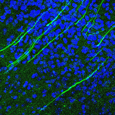 Immunostaining of mouse brain cortex identifying the calcium channels along axons stained with Anti-Cav1.3 Ca2+ Channel Antibody (Cat 75-080, 1:500, green) and nuclei are labeled with DAPI (blue).  Image kindly provided by Kaveh Moradi, Virginia Commonwealth University.