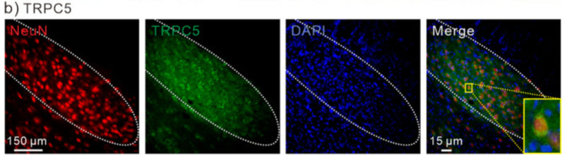 Immunostaining of NeuN (red), TRPC5 (green), DAPI (blue) and merged image in STN. Inset, enlarged merged image of a neuron. Image from publication CC-BY-4.0. PMID:36323817