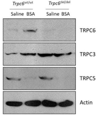 Immunoblot analysis showing abundance of TRPC family channels in renal cortex of wild type(wt) andTrpc6del/del rats. Image from publication CC-BY-4.0. PMID: 35805070