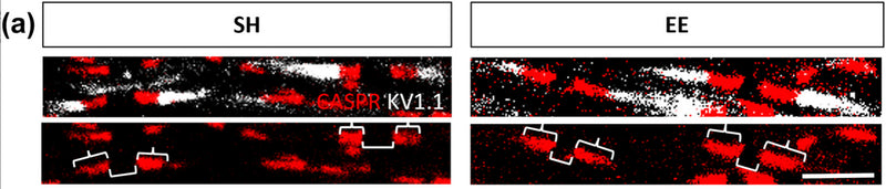 Representative confocal micrographs of paranode (CASPR, brace; red) pairs with interspersed node of Ranvier (bracket), demarcated by juxtaparanodes (KV1.1; white) in brain from with standard-housed (SH) or environmental enrichment (EE) mice. Image from publication CC-BY-4.0. PMID:36217300
